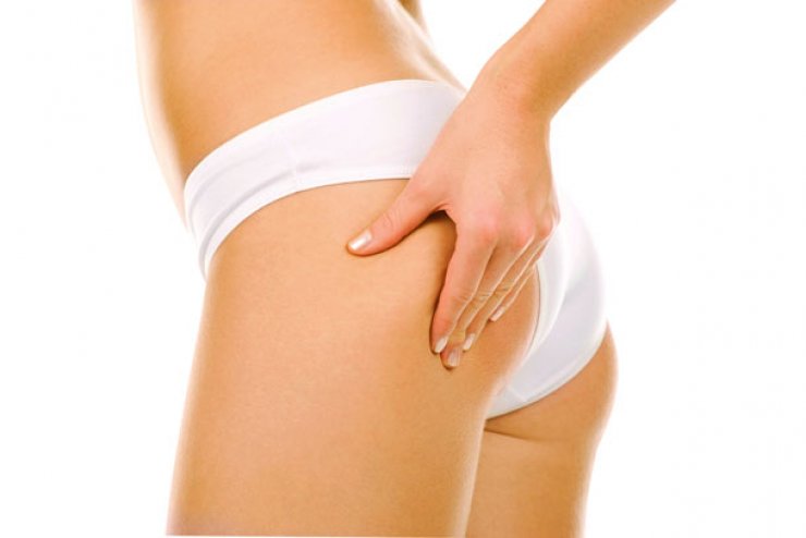 Καταπολεμήστε την κυτταρίτιδα σε μόνο 10 ημέρες!