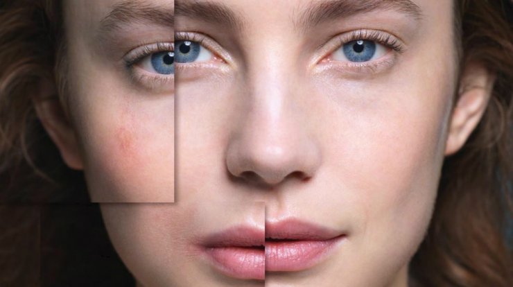   Toleriane Ultra Dermallergo Serum: Η καθημερινή  σταγόνα δύναμης  για το αλλεργικό δέρμα 