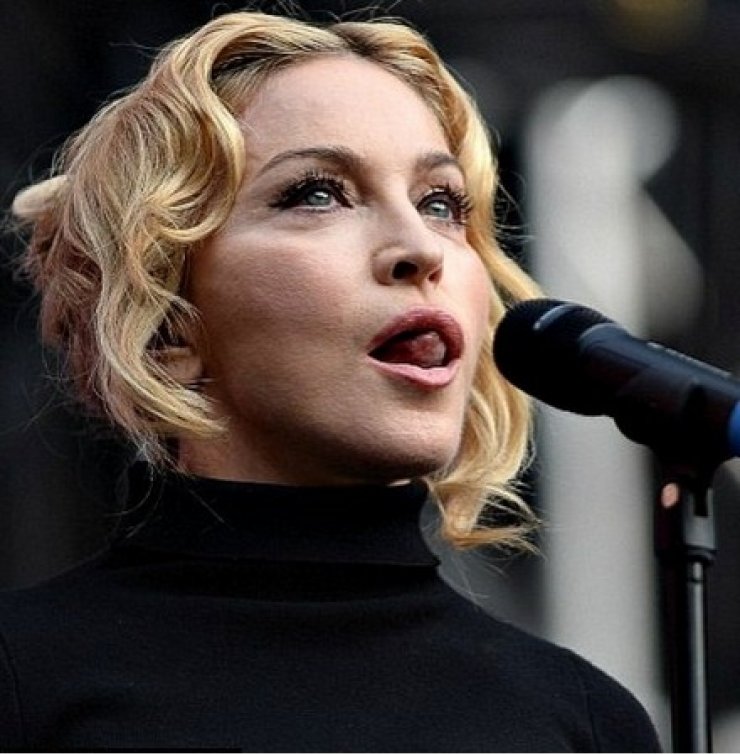 Madonna: Δείτε τον γιατρό που της έκανε όλες τις πλαστικές επεμβάσεις!