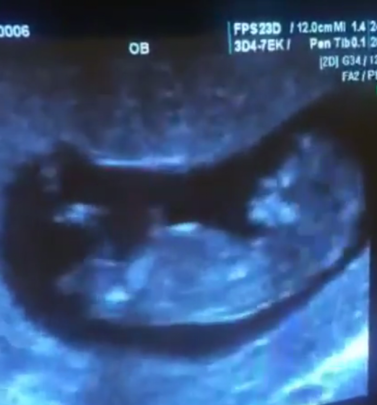 Ξανά γονείς πασίγνωστο ζευγάρι της ελληνικής showbiz!