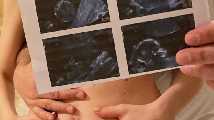 Έλληνας παρουσιαστής περιμένει το πρώτο του μωράκι! [εικόνες]