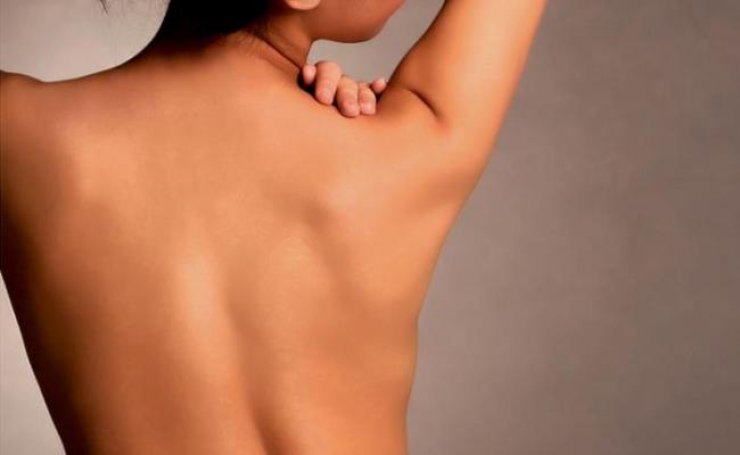 Σπυράκια στην πλάτη: Απαλλαγείτε σε 5 βήματα