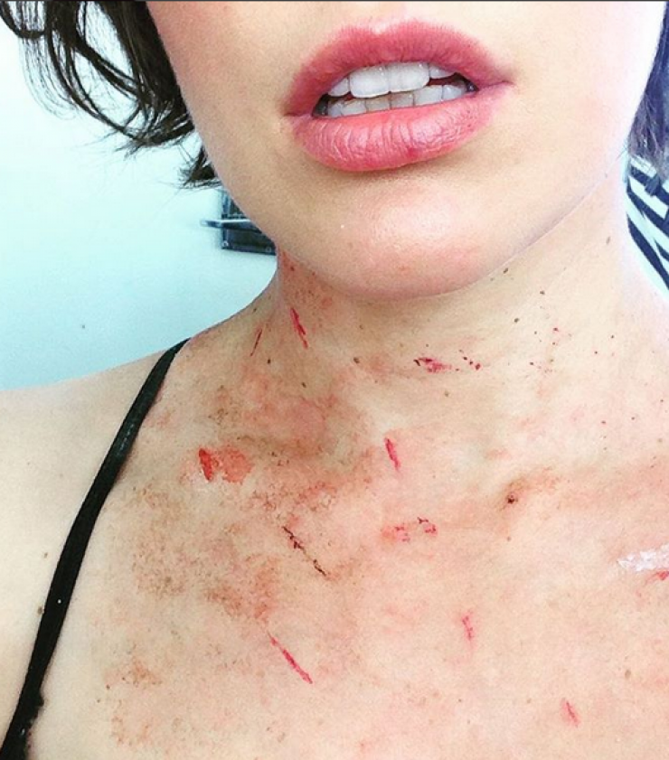 Δείτε τι έπαθε πασίγνωστη ηθοποιός!