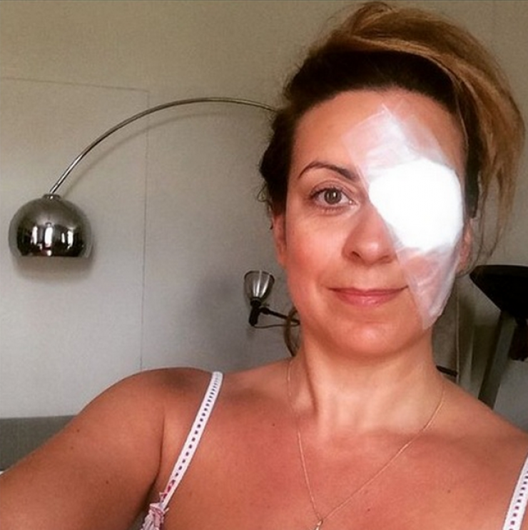 Ευαγγελία Μουμούρη: Το ατύχημα και οι γάζες στο μάτι!