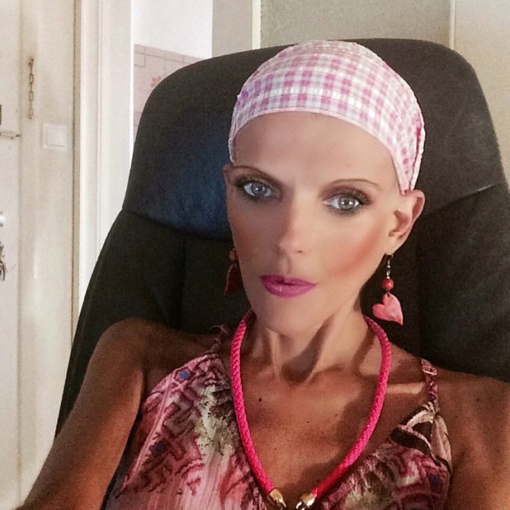 Νανά Καραγιάννη: Σε καταστολή για τουλάχιστον δέκα ημέρες μετά από εντολές των γιατρών-Ποια η εξέλιξη της υγείας της;