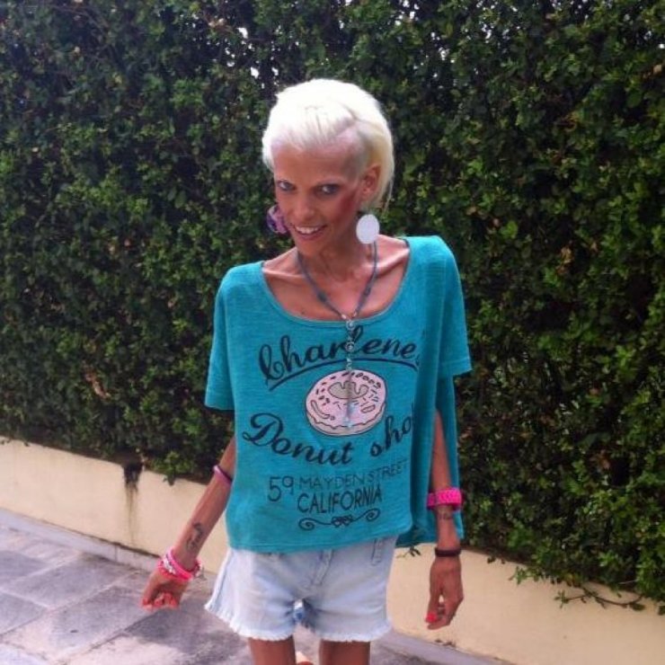 Νανά Καραγιάννη: Η χειρότερη φάση της αρρώστιας, ο χωρισμός και οι σφαλιάρες