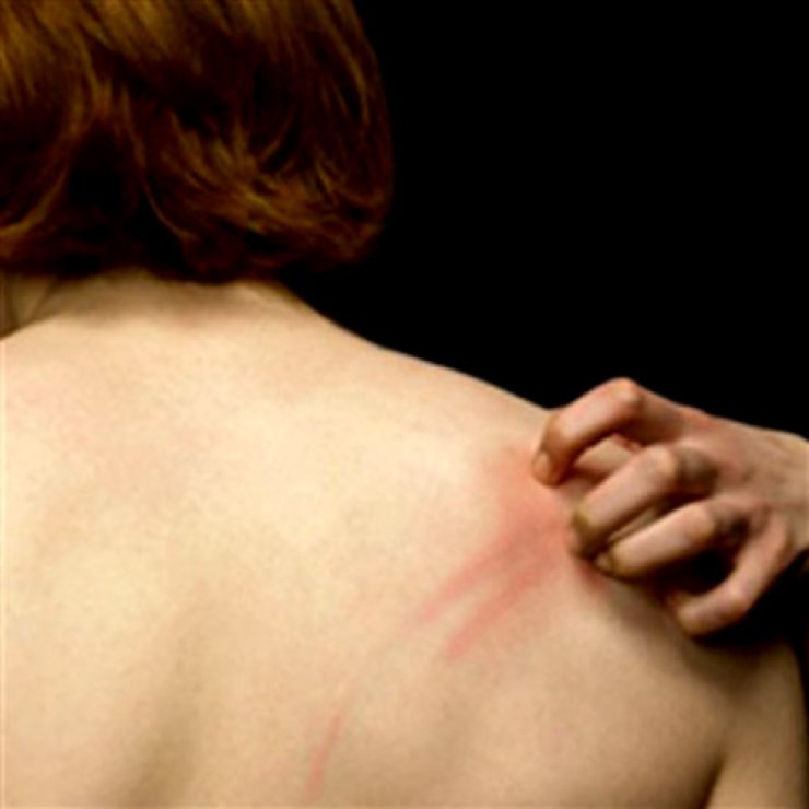 Άγχος και Δερματοπάθειες