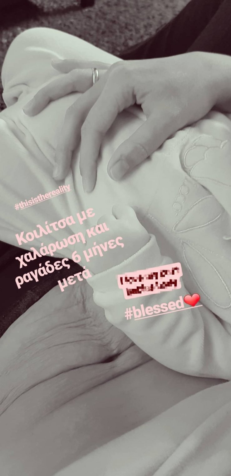 Επώνυμη της κυπριακής showbiz μας δείχνει την χαλάρωση και τις ραγάδες στην κοιλιά μετά την εγκυμοσύνη