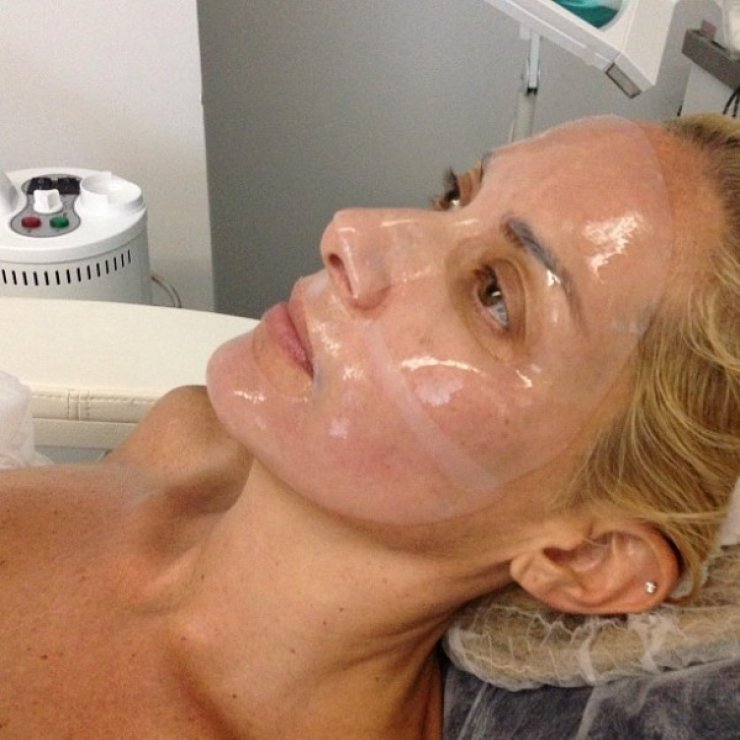 Η Ορθούλα Παπαδάκου κάνει… botox!