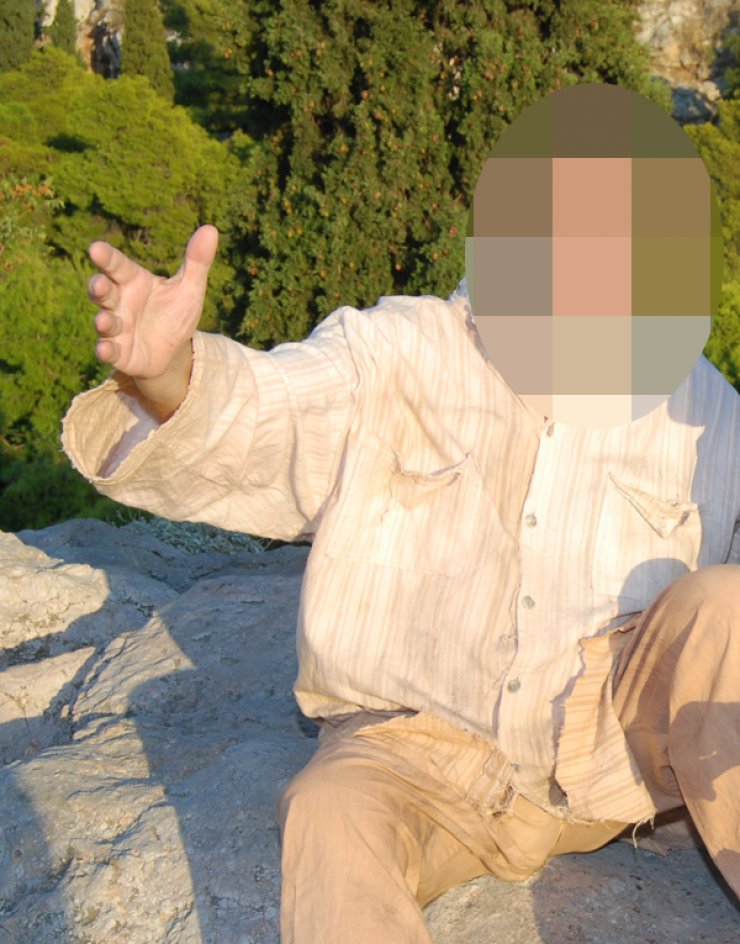 Έλληνας ηθοποιός δίνει μάχη στην εντατική εδώ και 17 μέρες