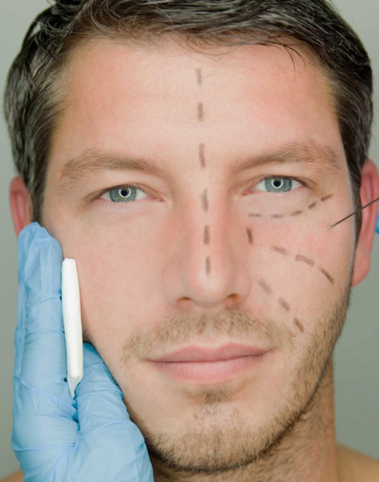 Η πλαστική χειρουργική δεν είναι μόνο γυναικείο προνόμιο