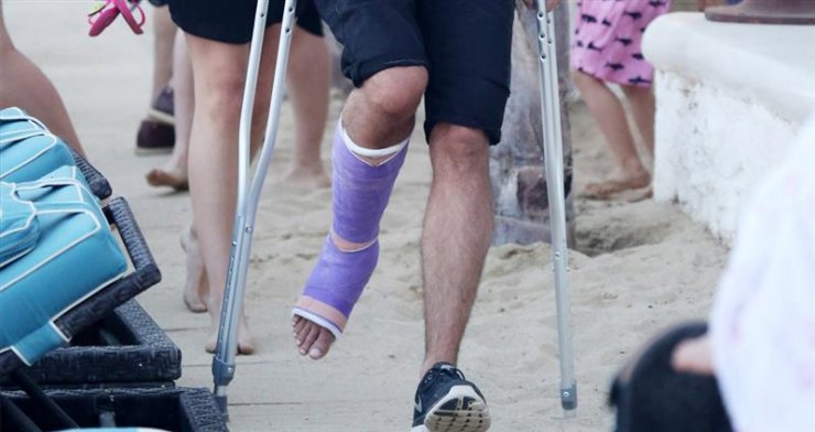 Γνωστός ηθοποιός κυκλοφορεί με σπασμένο πόδι στη Μύκονο! [εικόνες]