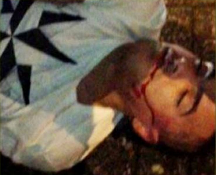 Σοκ! Γνωστός ποδοσφαιριστής αιμόφυρτος στο δρόμο μετά από καβγά