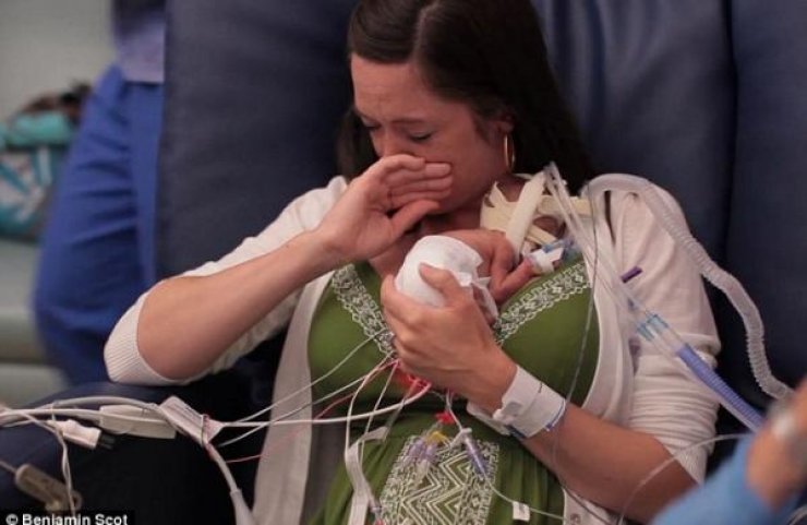 Η συγκλονιστική στιγμή που μια μαμά αγκαλιάζει για πρώτη φορά το πρόωρο μωράκι της