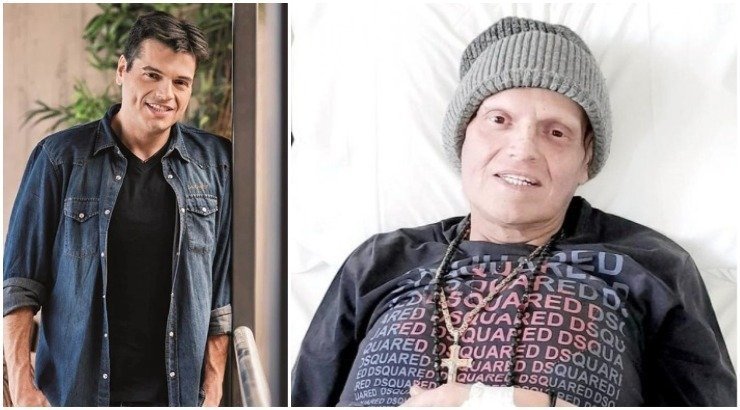 Γιώργος Δασκαλάκης: Συγκλονίζει δείχνοντας μας το σώμα του μετά τις πολλές χημειοθεραπείες και εγχειρήσεις