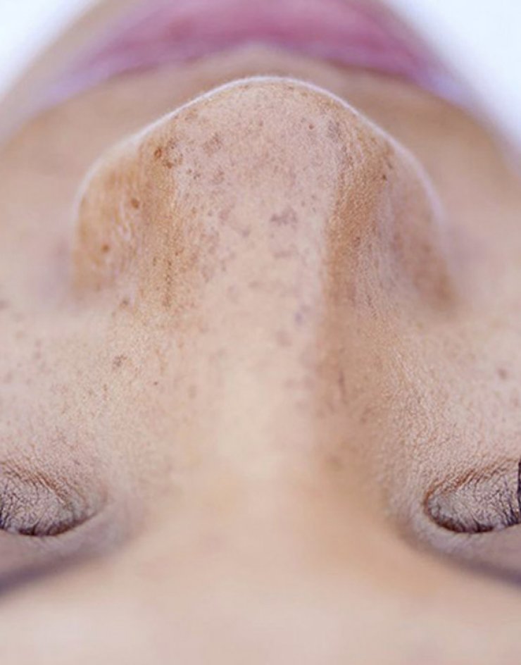 4 λόγοι που η ρετινόλη είναι η καλύτερη λύση ομορφιάς