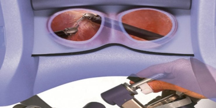 Επιδότηση προστατεκτομής Κυπρίων χωρίς ηλικιακά κριτήρια 