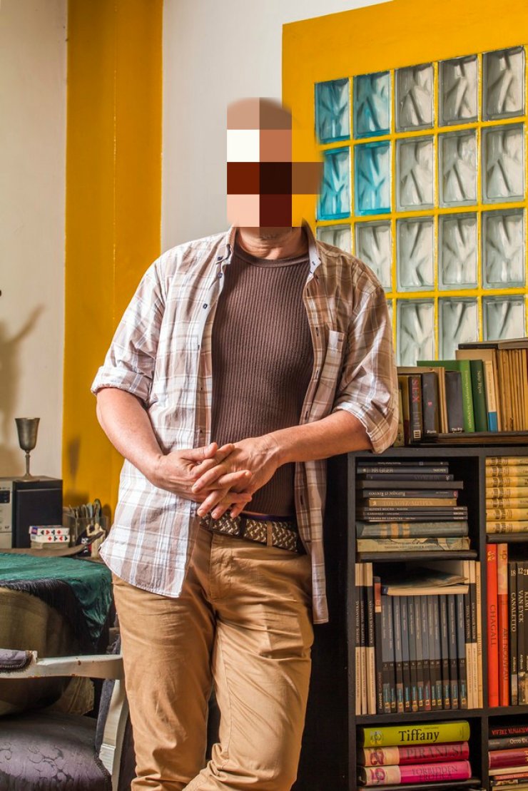 Συγκλονίζει γνωστός Έλληνας ηθοποιός: “Το μισό μου πρόσωπο είχε γίνει πολτός”