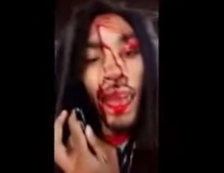 Απίστευτο! Πυροβόλησαν τραγουδιστή στο κεφάλι και εκείνος έβγαλε selfie βίντεο