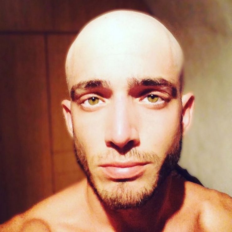 Θεοχάρης Ιωαννίδης: Ξακαθαρίζει πρώτη φορά τι συνέβη πραγματικά με τη φωτογραφία που ανέβασε χωρίς μαλλιά