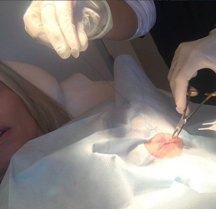 Η συγκλονιστική εξομολόγηση γνωστής ηθοποιού για τον καρκίνο!