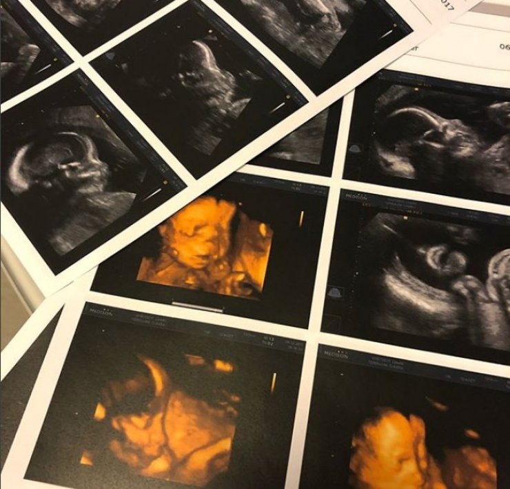 Μετά τις δυσκολίες που αντιμετώπισε έφερε στον κόσμο το πρώτο της παιδάκι και μας το ανακοίνωσε με τον πιο όμορφο τρόπο