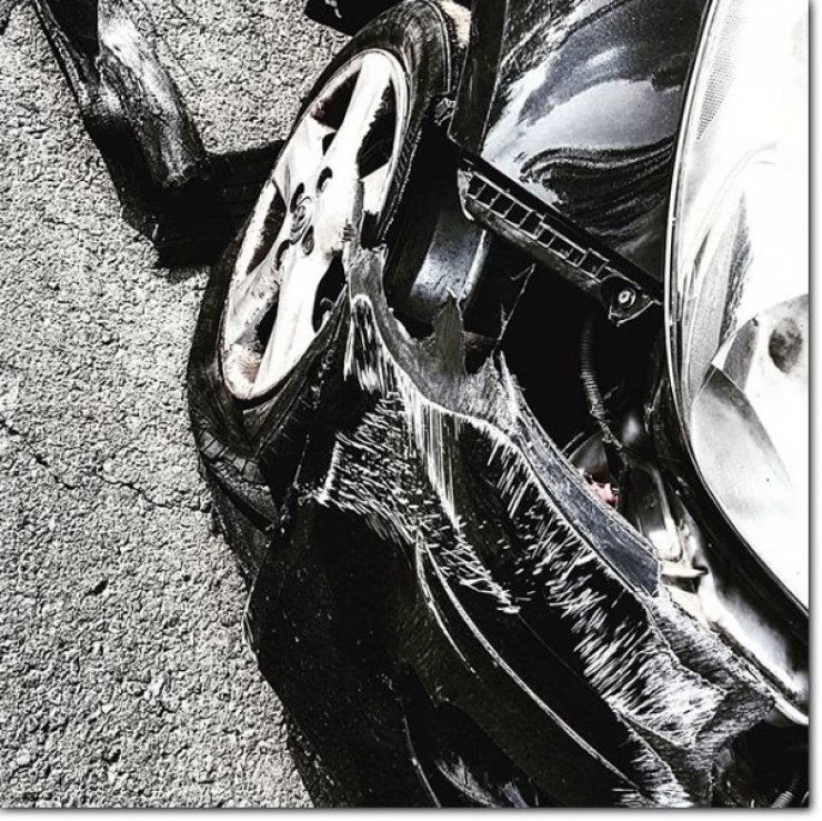 Σοβαρό ατύχημα για Κύπρια ηθοποιό!