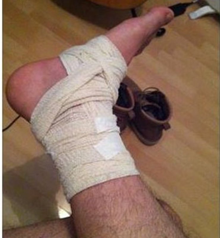 Ποιος Κύπριος ηθοποιός έσπασε το πόδι του πριν την πρεμιέρα της παράστασης του;