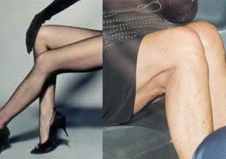 Έφτασε στα 81 αλλά τα φημισμένα πόδια της "κρατούν" ακόμη με μικρές απώλειες...