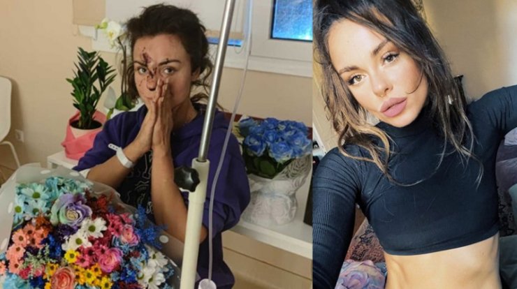 Παίκτρα του Big Brother ήταν στο βαγόνι 3 του φονικού τρένου: "Έπρεπε να αποφασίσω αν θα καώ ή θα σπάσω τα κόκαλά μου"