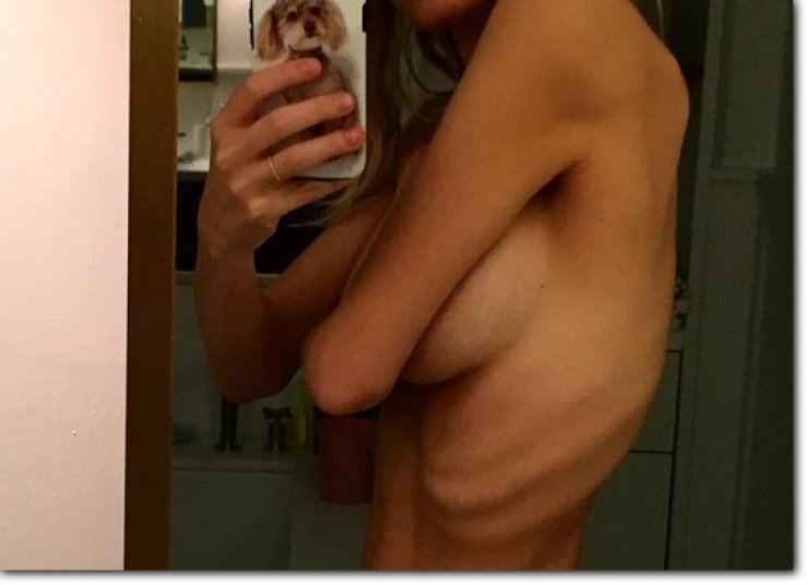 Γνωστή ηθοποιός σοκάρει με την εικόνα της!