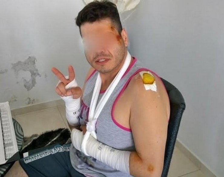 Έλληνας τραγουδιστής χτύπησε άσχημα στο κεφάλι [εικόνα]