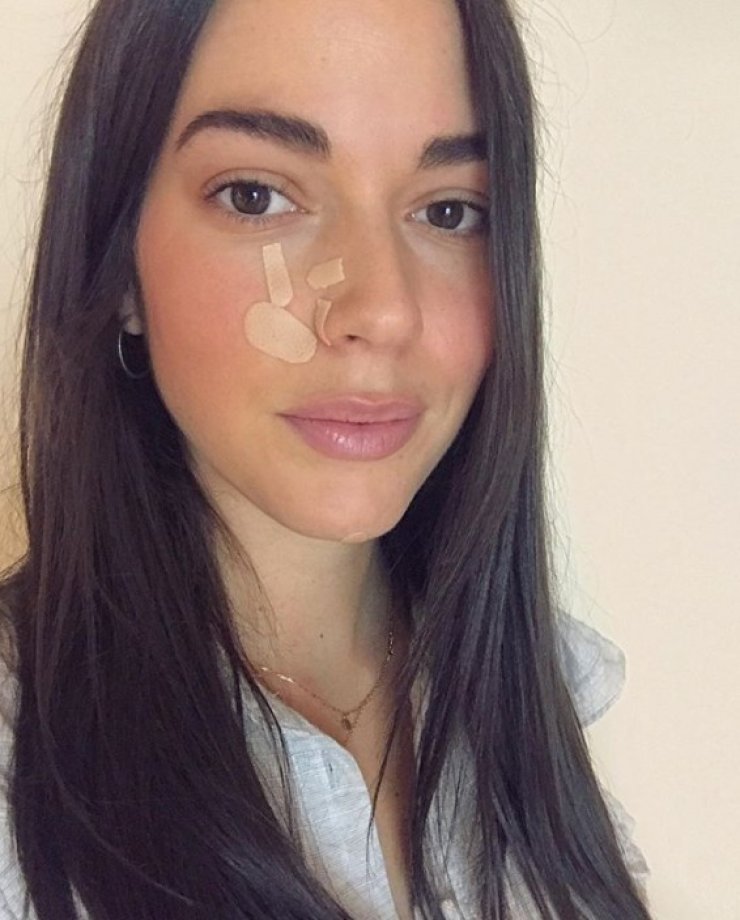 Ισμήνη Νταφοπούλου: Πώς είναι το πρόσωπό της τρεις μήνες μετά τον σοβαρό τραυματισμό