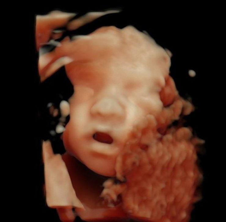 Άρχισαν οι αποκαλύψεις για τις επικείμενες γεννήσεις της showbiz