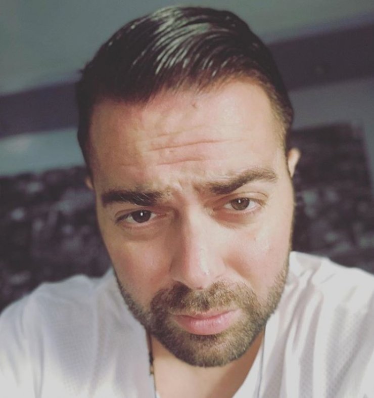 Ηλίας Βρεττός: Μας δείχνει πρώτη φορά τα τραύματα που του έμειναν ενάμιση μήνα μετά το τροχαίο