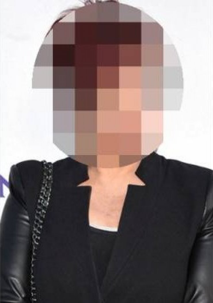 Πασίγνωστη παρουσιάστρια παραδέχτηκε για τις πλαστικές επεμβάσεις της: