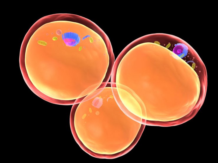 Λιπομεταφορά: H δημοφιλής λύση