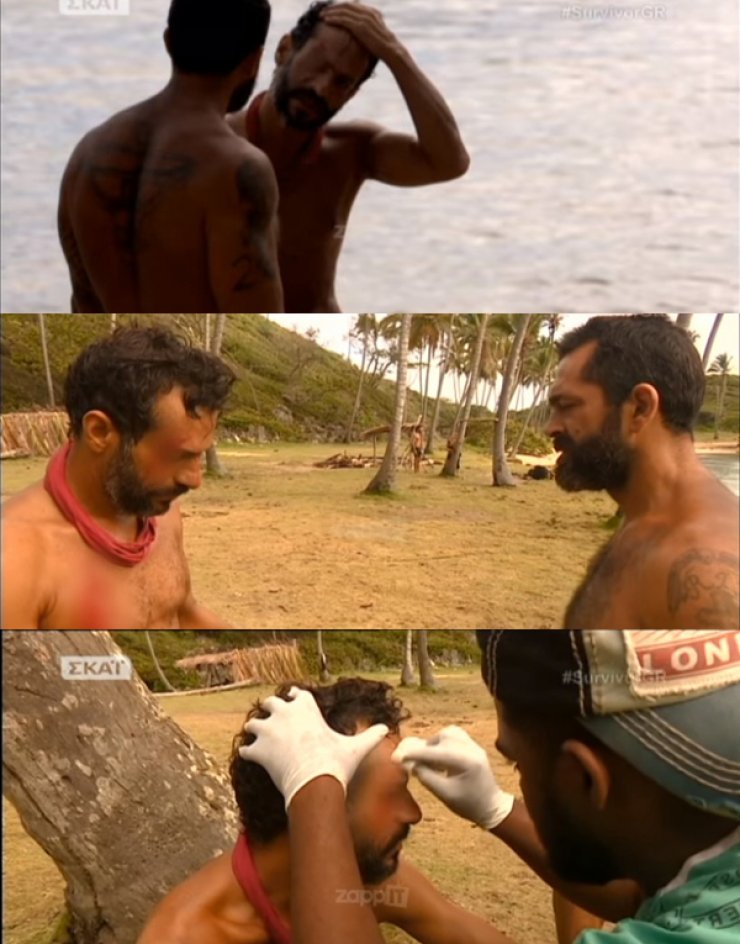 Σοβαρό ατύχημα στην παραλία για τον Γιώργο Χρανιώτη - Γέμισε αίματα το πρόσωπό και το στήθος του!