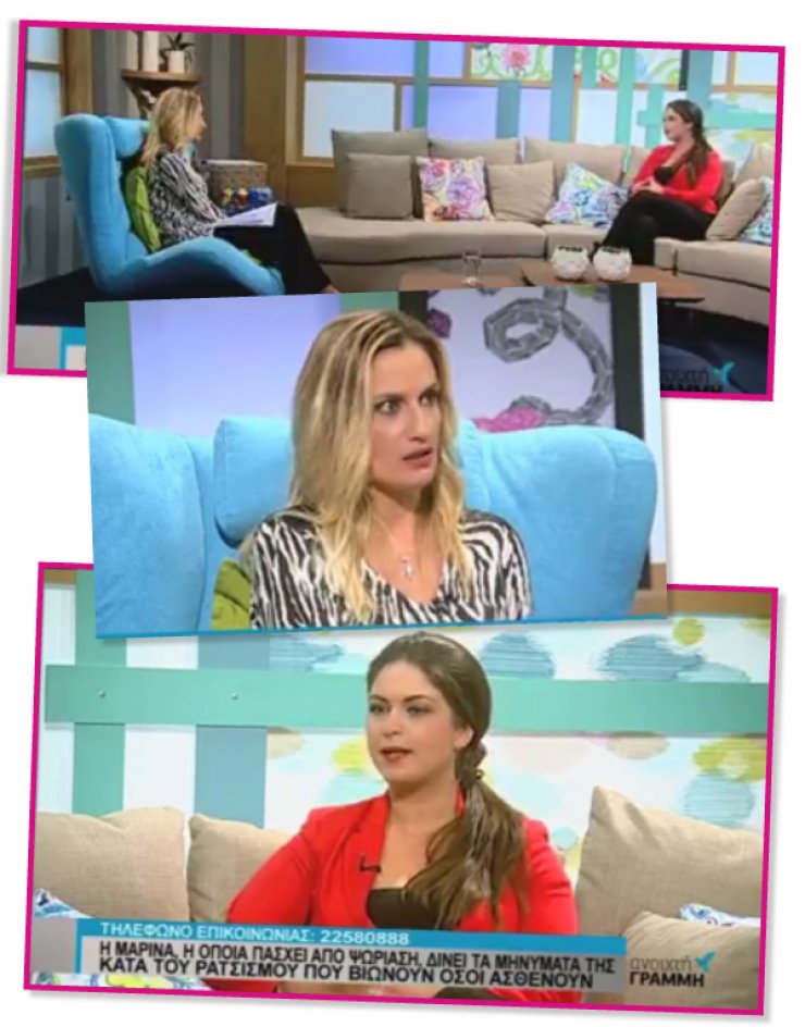 Μαρίνα Χατζηκώστα: Η νέα συγκλονιστική εξομολόγηση της για την ψωρίαση