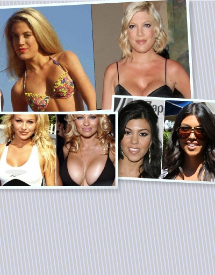 Πώς ήταν οι αγαπημένες μας stars πριν τις επεμβάσεις στο στήθος; [εικόνες] 