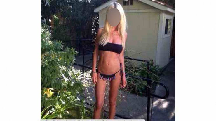 Σοκ με τις σκελετωμένες φωτογραφίες γνωστής ηθοποιού [εικόνες]