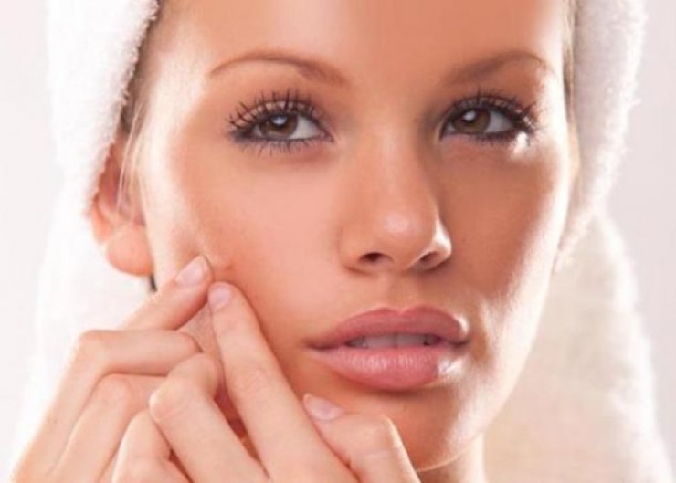 Όλα όσα πρέπει να γνωρίζετε για το σπυράκι 