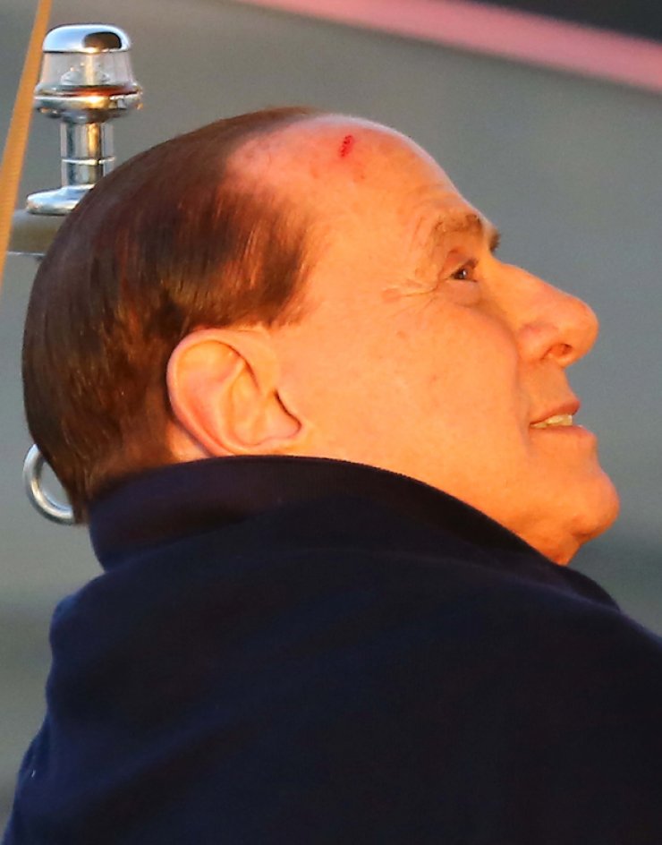 Το ατύχημα του Silvio Berlusconi [εικόνες]