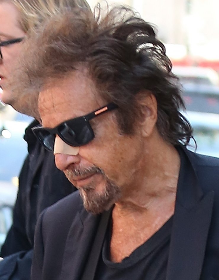 Το ατύχημα που είχε πασίγνωστος σταρ του Hollywood [εικόνες]