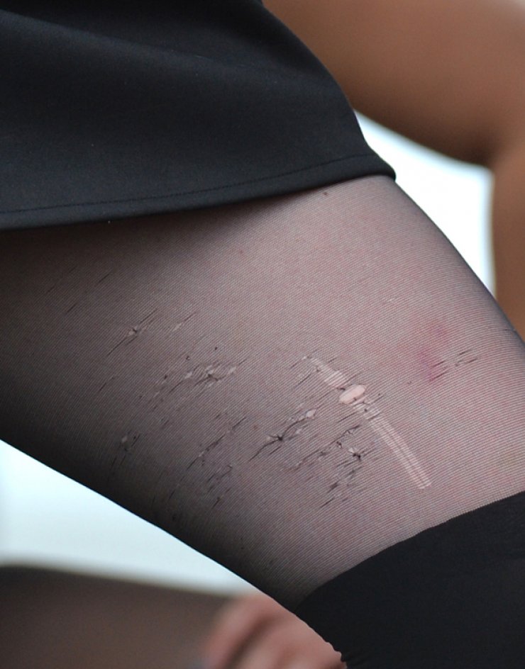 Ανερχόμενη τραγουδίστρια ανέβηκε στη σκηνή με σκισμένο καλτσόν [εικόνες]