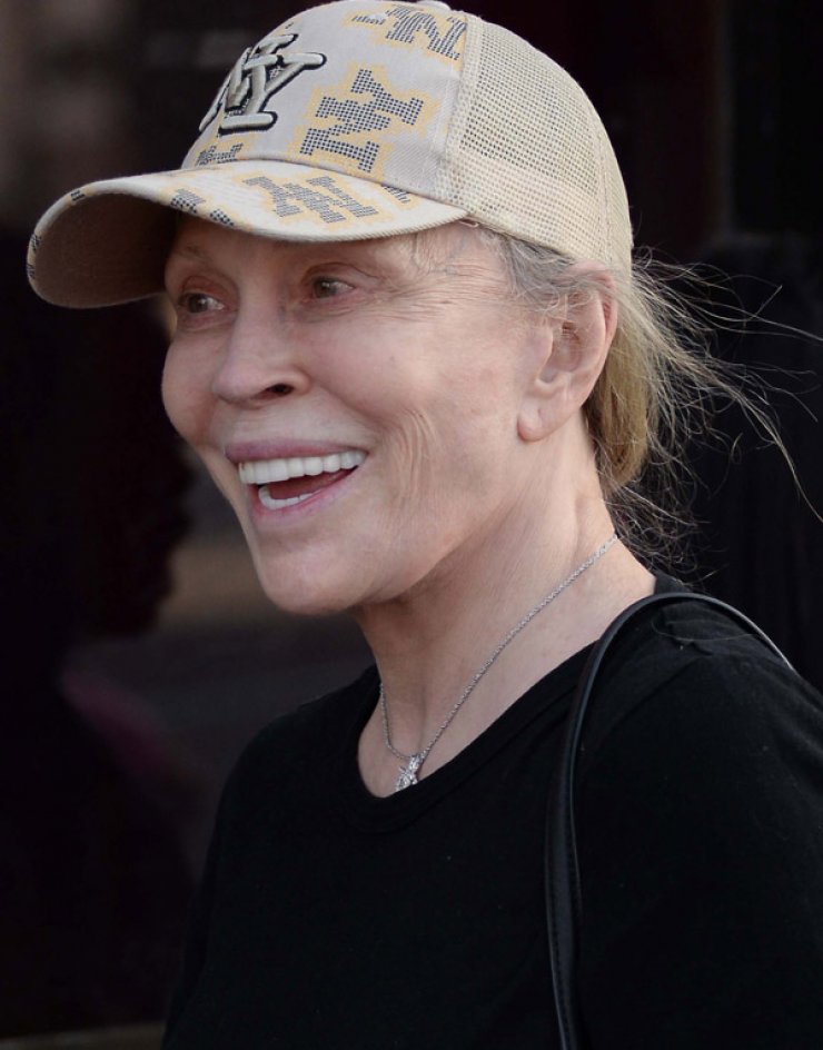 Δείτε πως έγινε 74χρονη πασίγνωστη σταρ του Hollywood έπειτα από απανωτές πλαστικές [εικόνες]