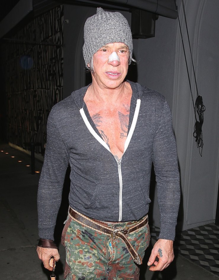 Τραυματίστηκε ο Mickey Rourke; [εικόνες]