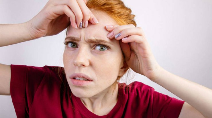 DIY μάσκα που εξαφανίζει την ακμή 