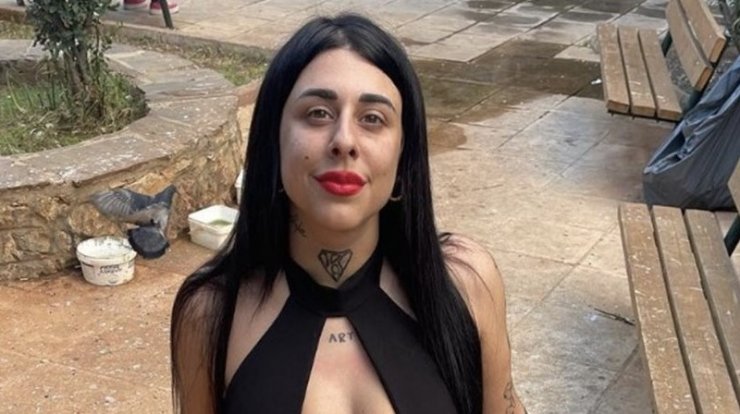 Super Κική: Μόλις έκανε λιποαναρρόφηση - Δείτε πως είναι το σώμα της