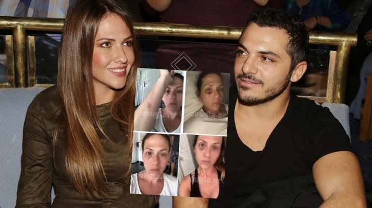 Kώστας Δόξας - Μαρία Δεληθανάση: Στα δικαστήρια μετά τις καταγγελίες ξυλοδαρμού [βίντεο]